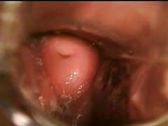 UhFuck presents: Gyno speculum exam